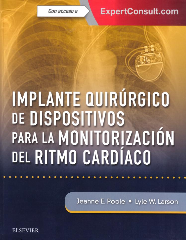 Implante Quirúgico De Dispositivos Para La Monitorización Del Ritmo Cardiáco + Expertconsult