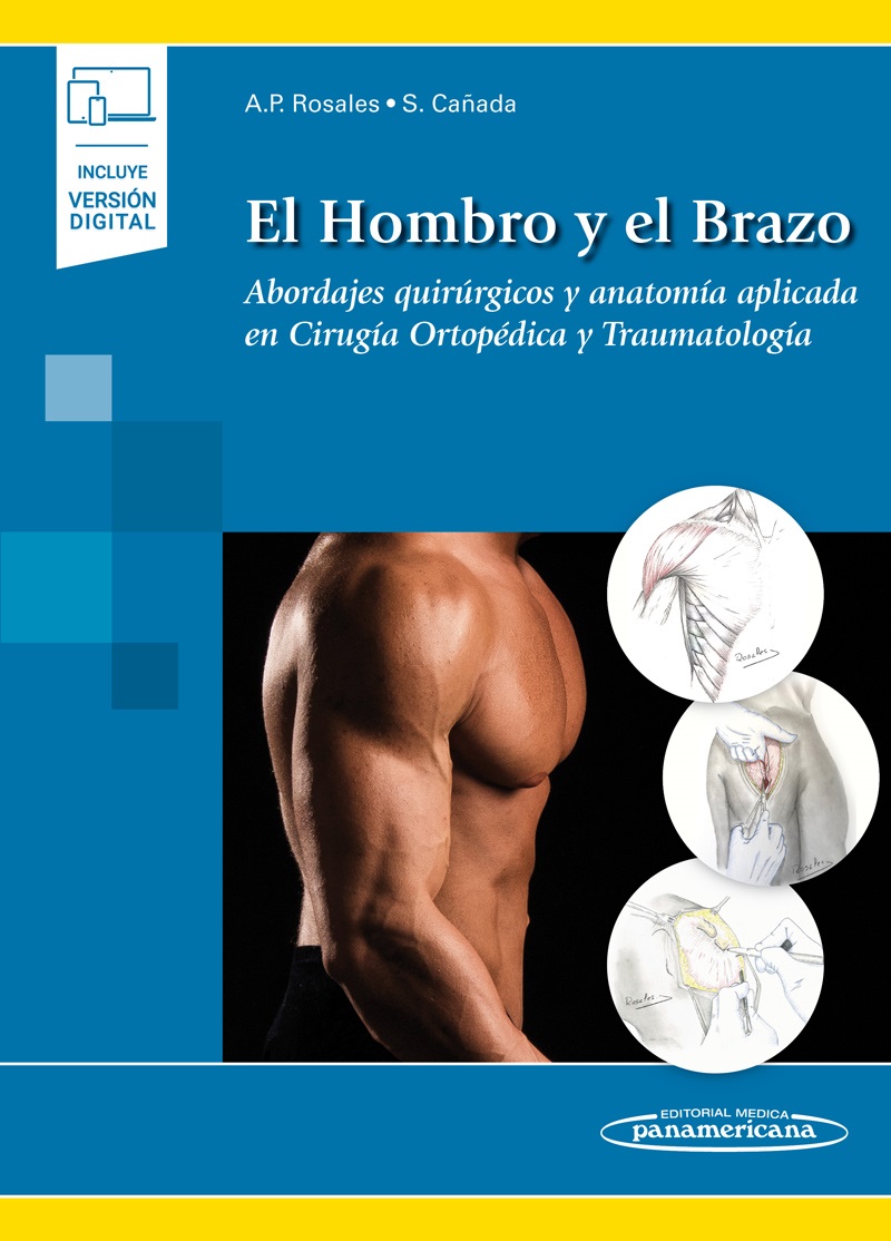 El Hombro Y El Brazo Abordajes Quirúrgicos Y Anatomía Aplicada En Cirugía Ortopédica Y Traumatología Incluye Ebook