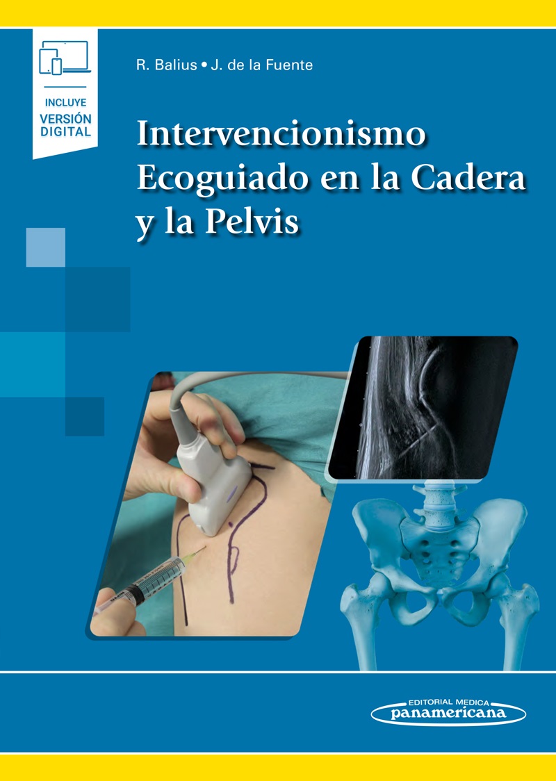 Intervencionismo Ecoguiado En La Cadera Y La Pelvis Incluye Ebook