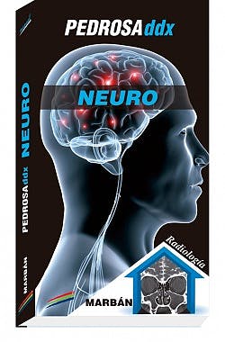 Pedrosa Ddx: Neuro