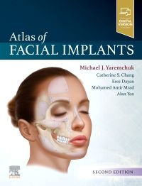 Atlas Of Facial Implants, 2Nd Edition