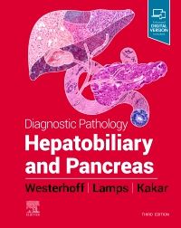 Diagnostic Pathology : Hepatobiliary And Pancreas, 3Rd Edition