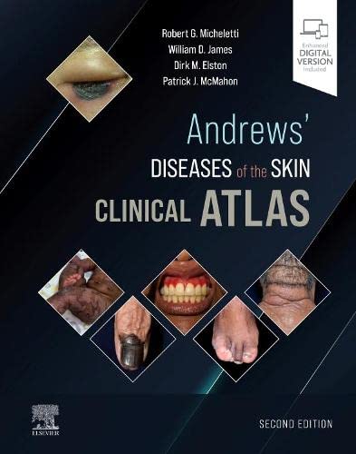 Andrews' Diseases Of The Skin Clinical Atlas,