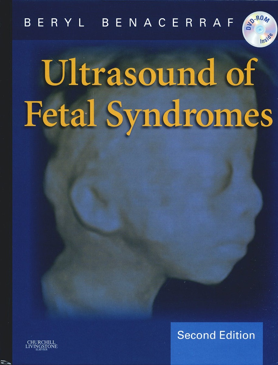 Ultrasound Of Fetal Syndromes