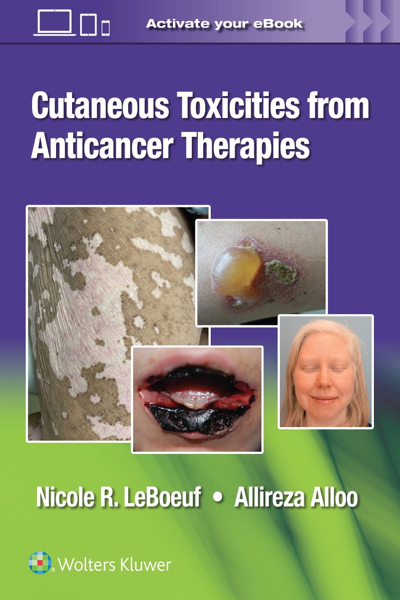 Cutaneous Reactions To Anti-Cancer Therapies