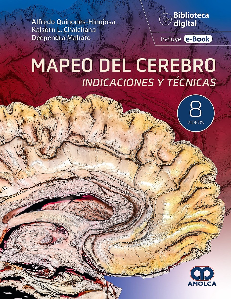 Mapeo del Cerebro. Indicaciones y Técnicas
