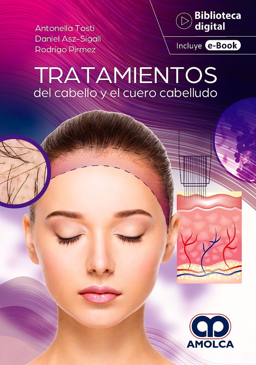 Tratamientos del Cabello y el Cuero Cabelludo