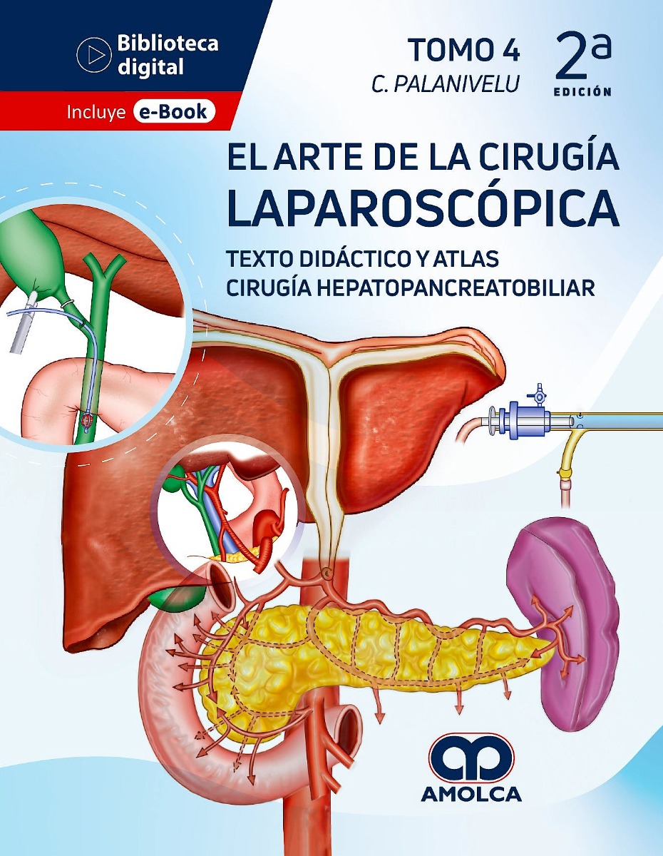 El Arte de la Cirugía Laparoscópica Tomo 4