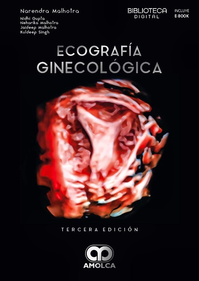 Ecografía ginecológica