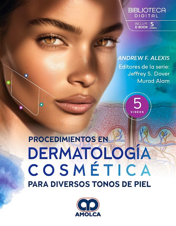 Procedimientos en Dermatología Cosmética para Diversos Tonos de Piel