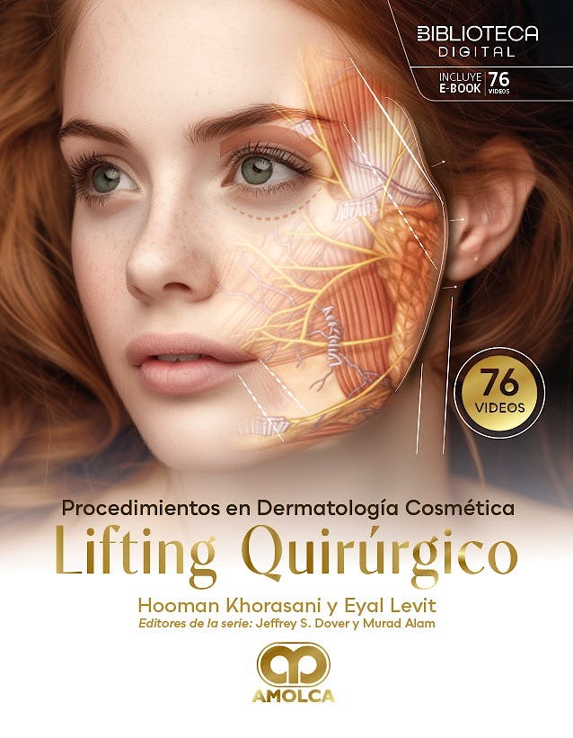 Procedimientos en Dermatología Cosmética. Lifting Quirúrgico