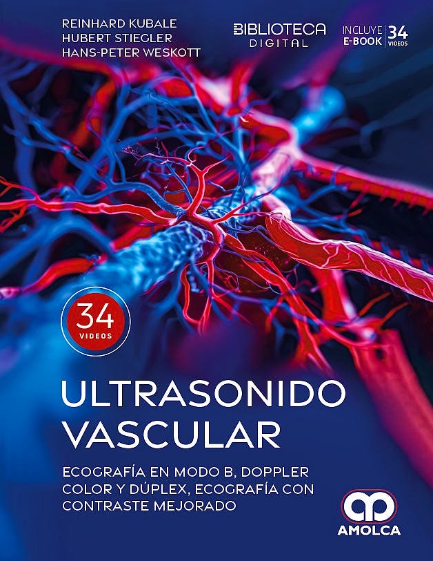 Ultrasonido Vascular.