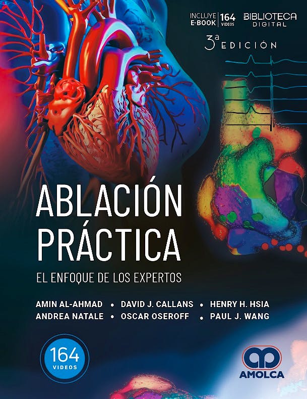 Ablación Práctica. El Enfoque de los Expertos