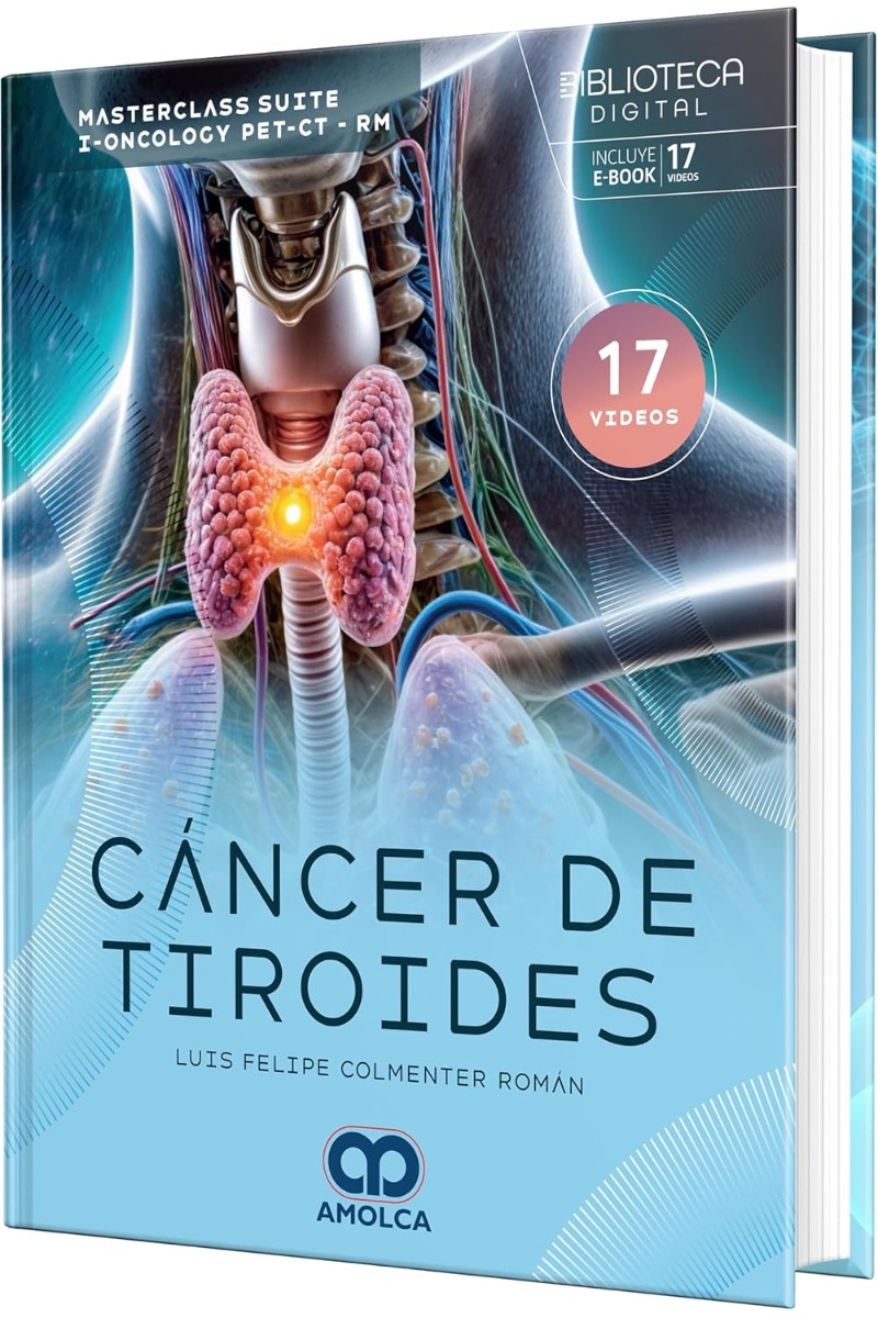 Cáncer de Tiroides. Masterclass Suite I-Oncology PET-CT-RM