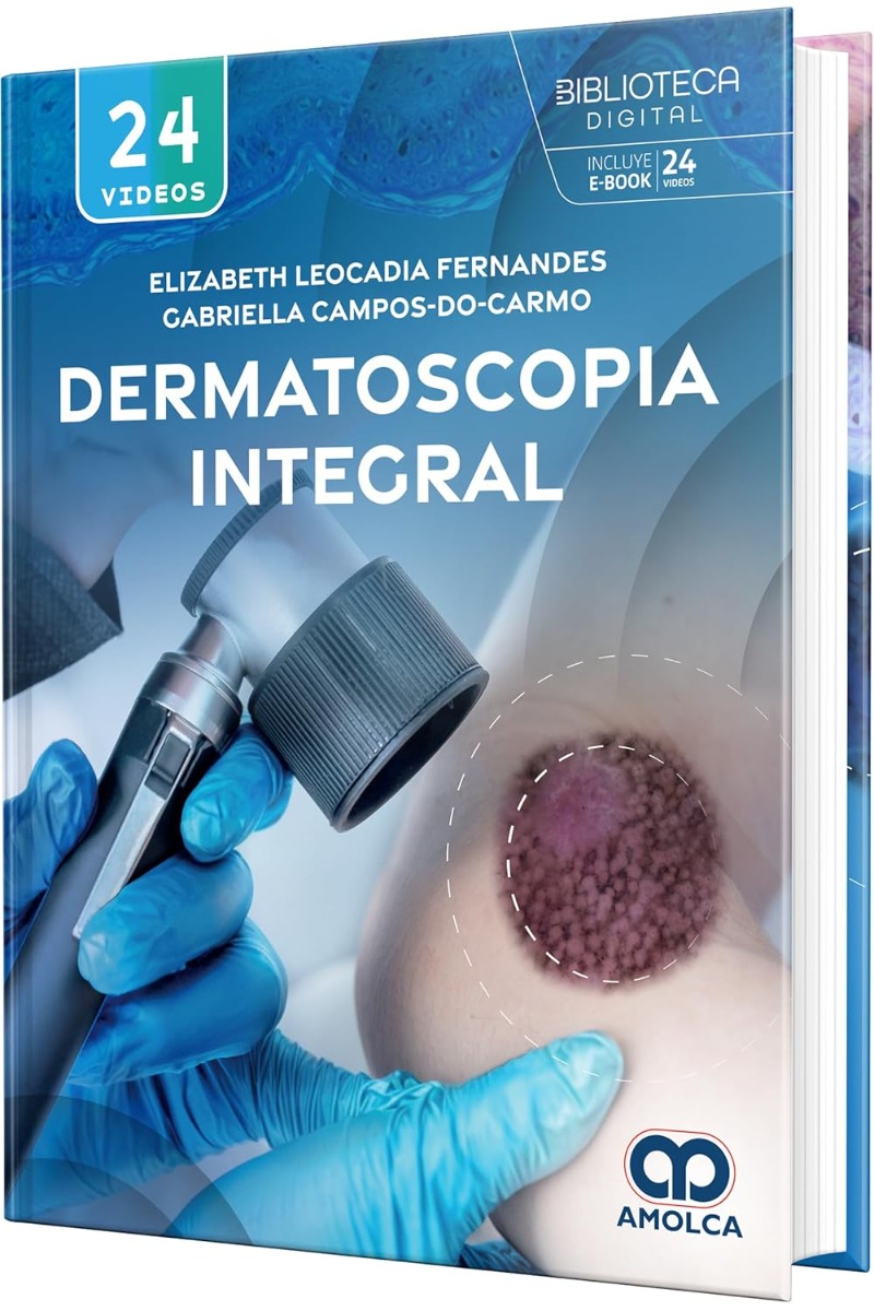 Dermatoscopia Integral
