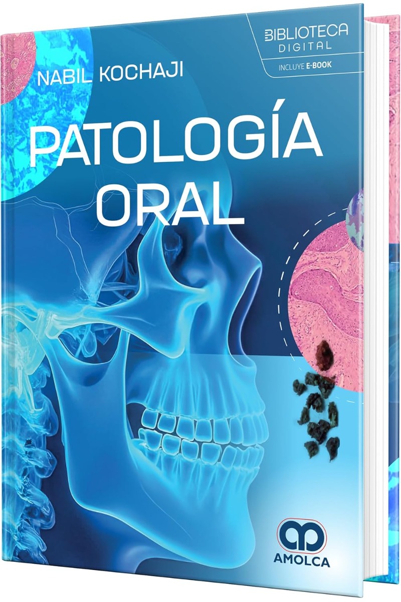 Patología Oral 1ª