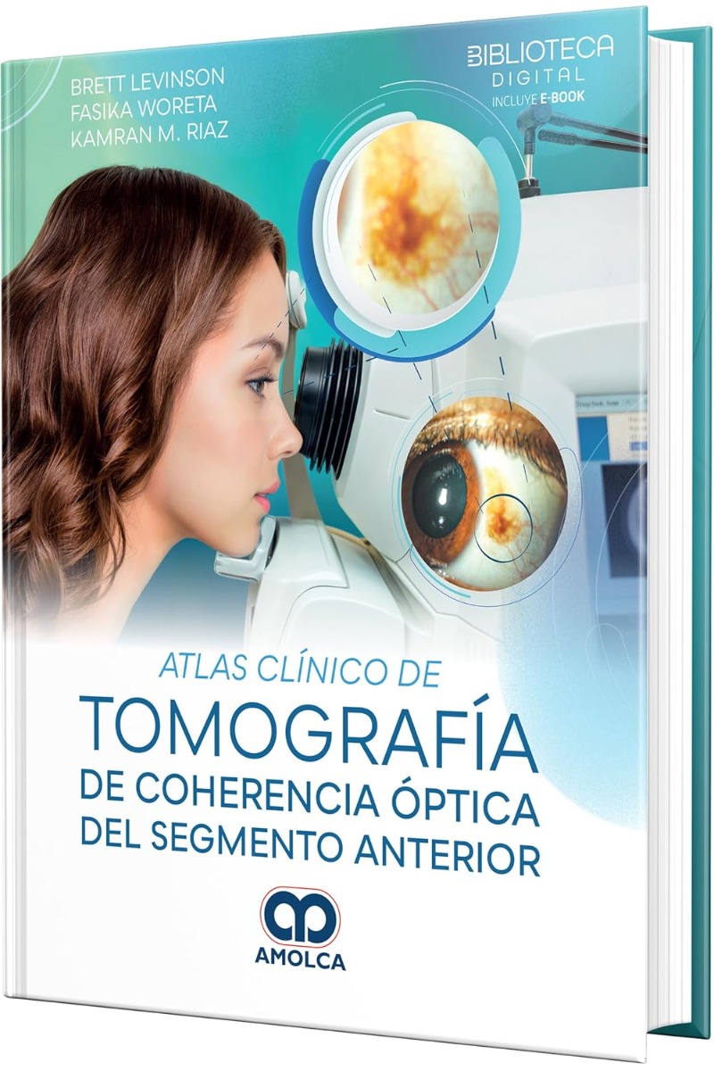 Atlas Clínico de Tomografía de Coherencia Óptica del Segmento Anterior