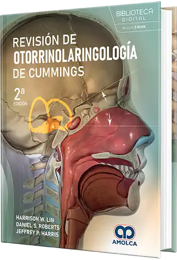 Revisión de Otorrinolaringología de CUMMINGS