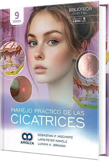 Manejo Práctico de las Cicatrices