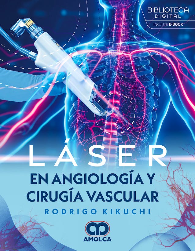 Láser en Angiología y Cirugía Vascular