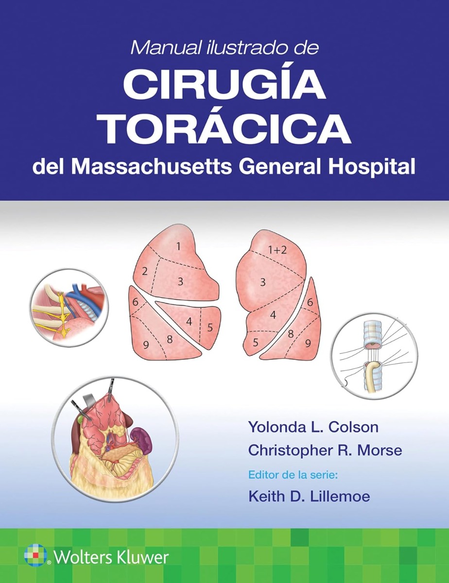 Manual ilustrado de Cirugía torácica del Massachusetts General Hospital
