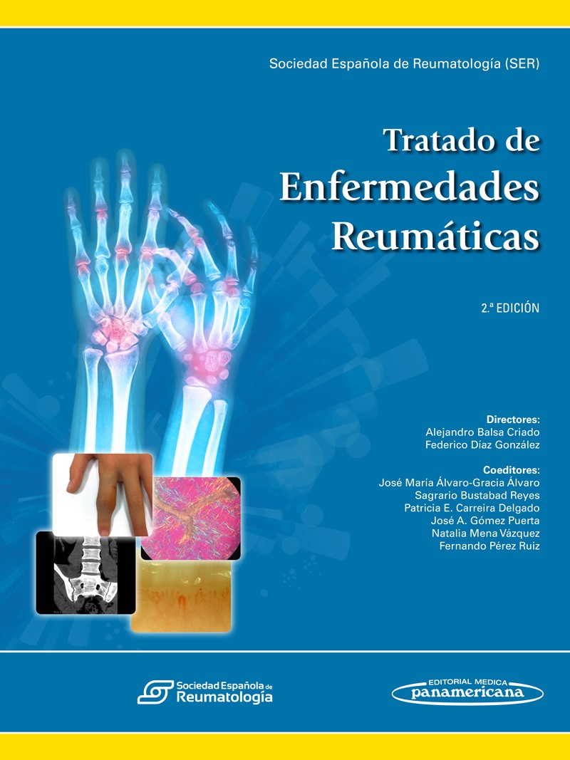 Tratado de Enfermedades Reumáticas