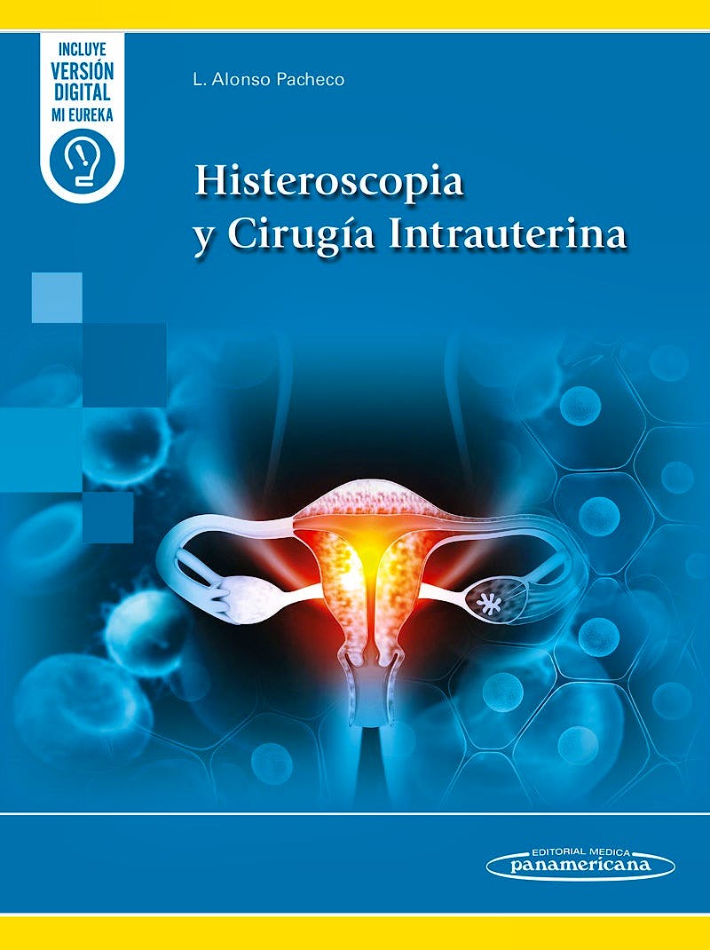 Histeroscopia y Cirugía Intrauterina.