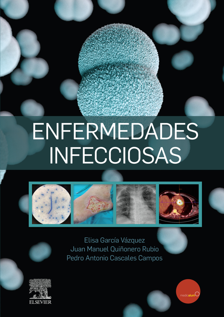 Enfermedades Infecciosas