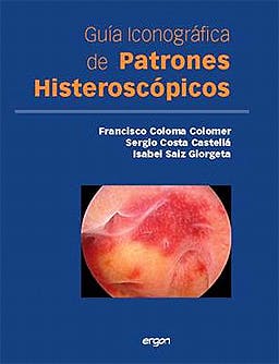 Guia Iconografica De Patrones Histeroscopicos