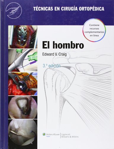 Técnicas En Cirugía Ortopédica, El Hombro