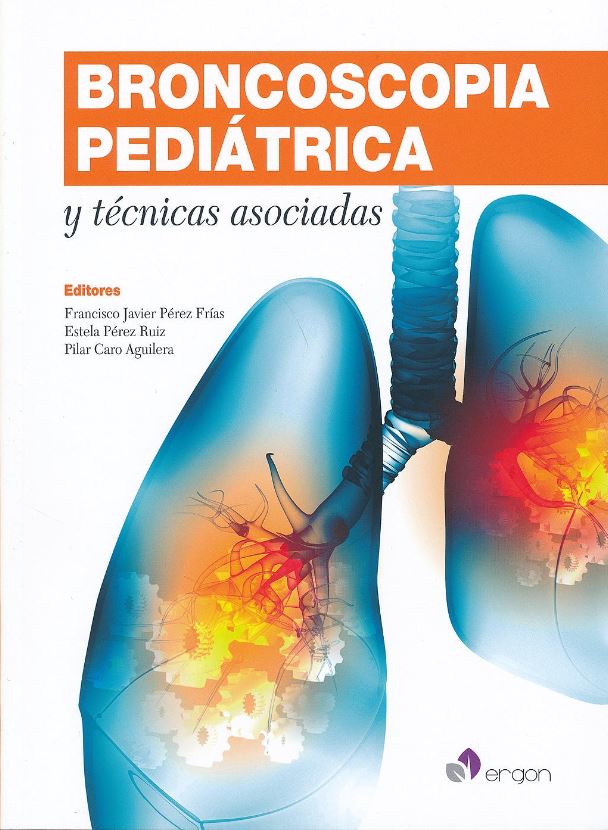 Broncoscopia Pediatrica Y Tecnicas Asociadas