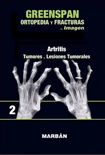 Ortopedia y Fracturas en Imagen, Vol. 2: Artritis. Tumores y Lesiones Tumorales