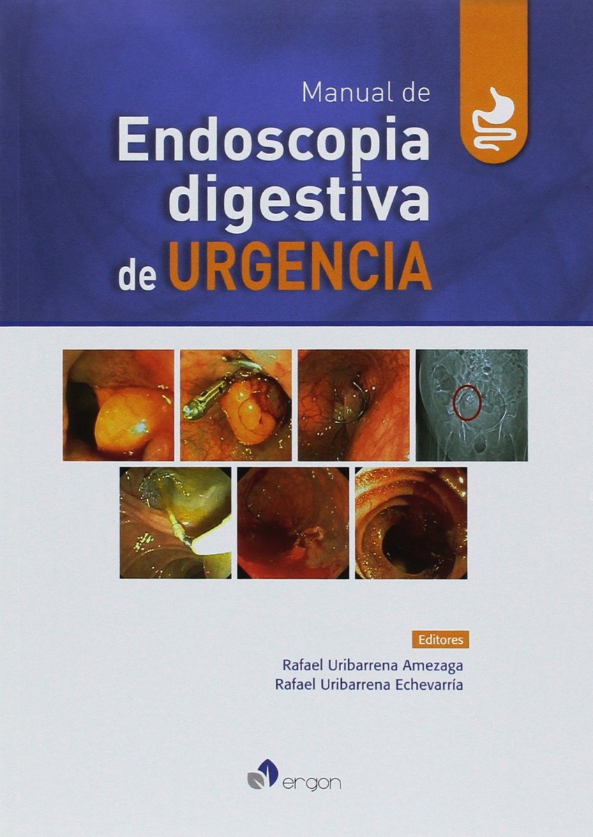 Manual de Endoscopia digestiva de Urgencia
