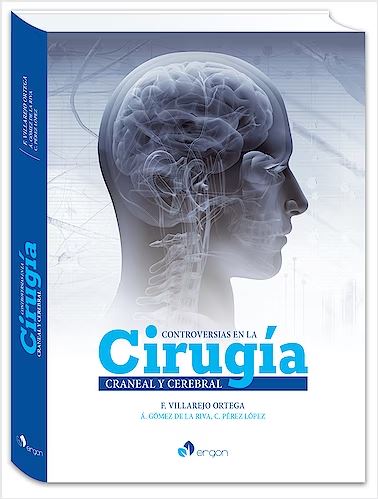 Controversias en la Cirugía Craneal y Cerebral