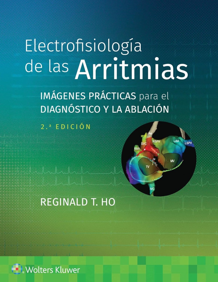 Electrofisiología de las Arritmias