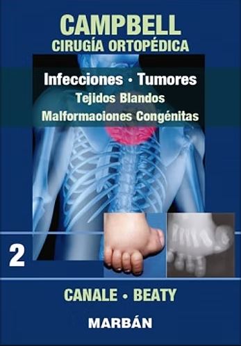 Campbell Cirugía Ortopédica, Tomo 2: Infecciones. Tumores: Tejidos Blandos. Malformaciones Congénitas