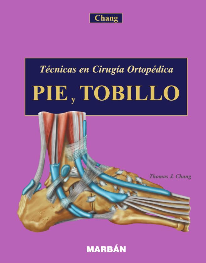 Pie y Tobillo. Técnicas en Cirugía Ortopédica