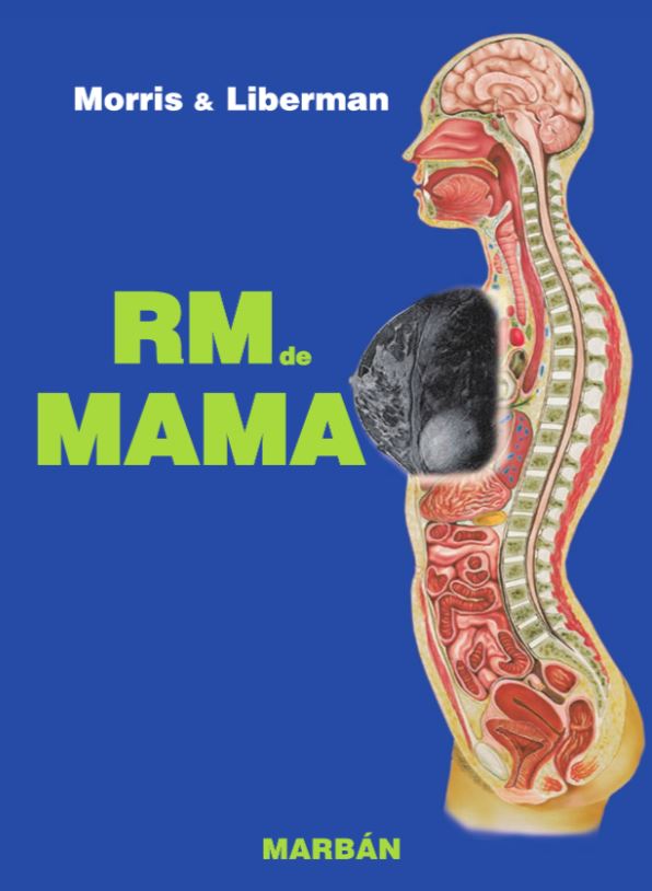 RM de Mama