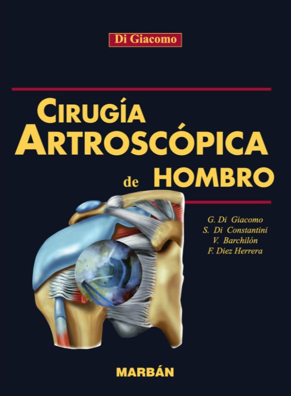 Cirugía Artroscópica del Hombro Flexilibro