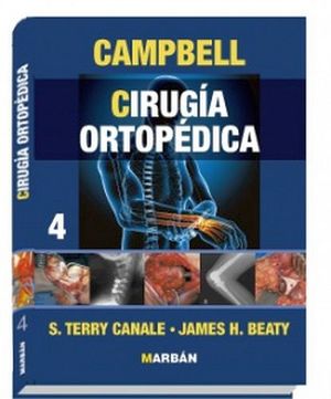 Cirugia Ortopedica Y Traumatologia Vol 4