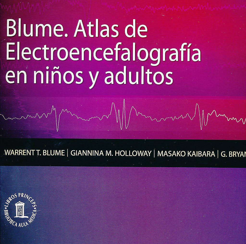 Blume. Atlas De Electroencefalografia En Niños Y Adultos