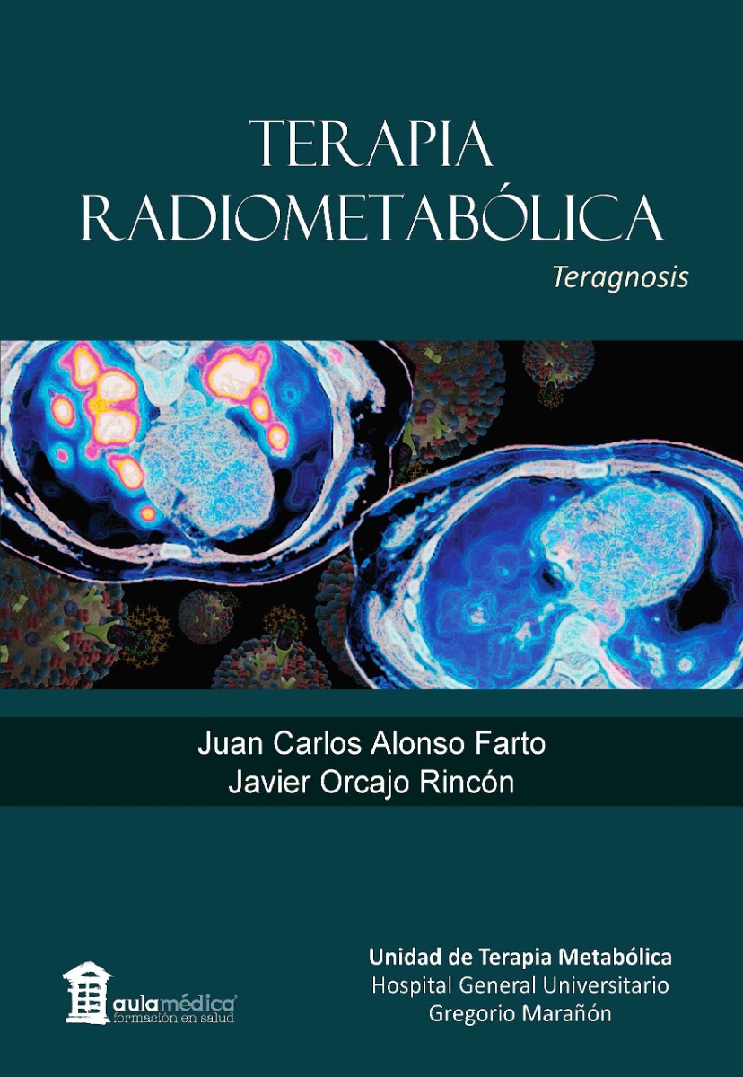 Terapia Radiometabólica