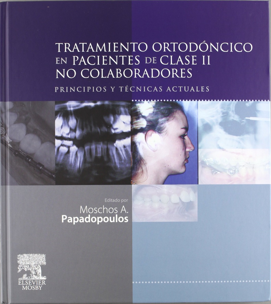 Tratamiento Ortodontico En Pacientes De Clase Ii No Colaboradores