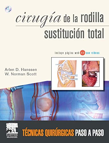 Cirugía la rodilla. Sustitución total + DVD