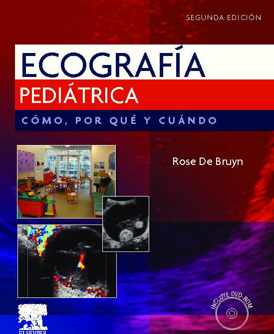Ecografía Pediátrica. Cómo, Por Qué Y Cuándo 2Ed