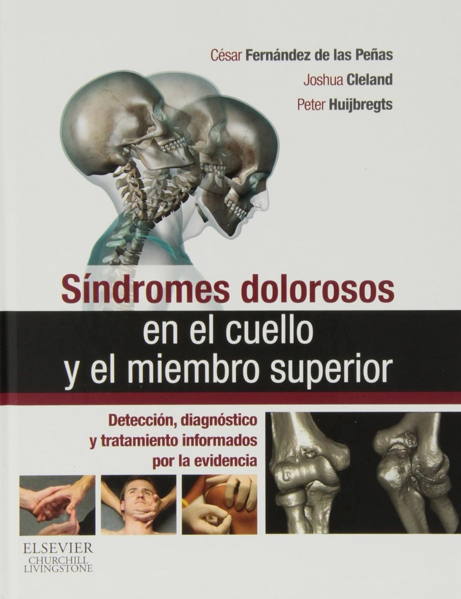 Síndrome doloroso en el cuello y el miembro superior