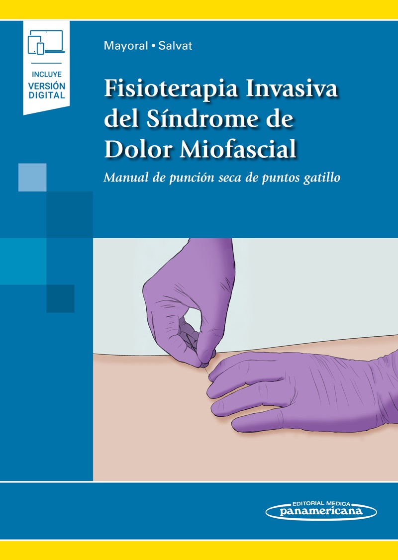 Fisioterapia Invasiva Del Síndrome De Dolor Miofascial