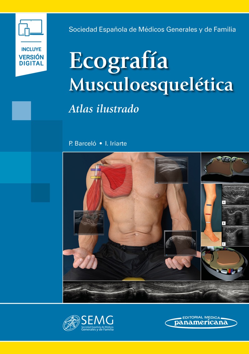 Ecografía Musculoesquelética Atlas Ilustrado