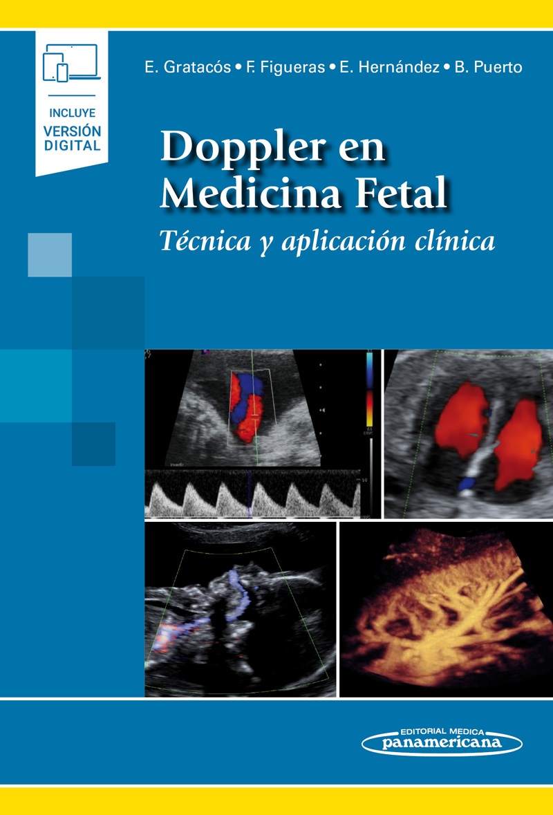 Doppler En Medicina Fetal