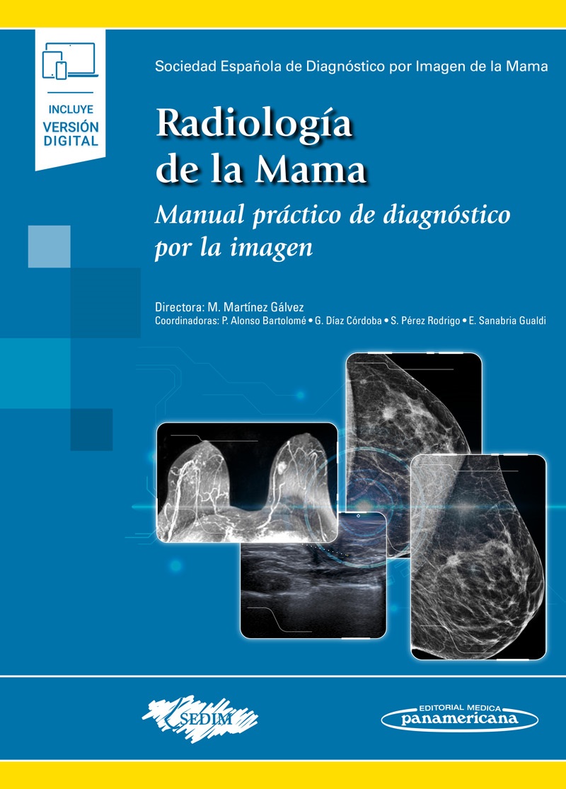 Radiología De La Mama Manual Práctico De Diagnóstico Por La Imagen
